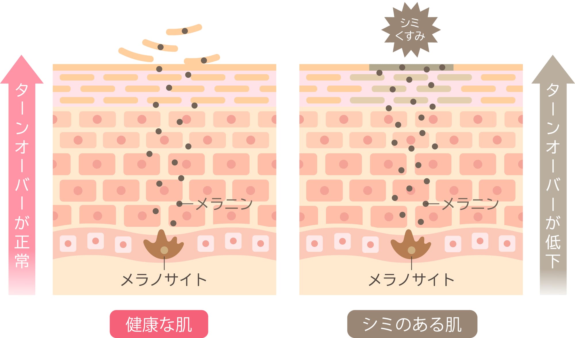 シミやくすみはエイジングサイン