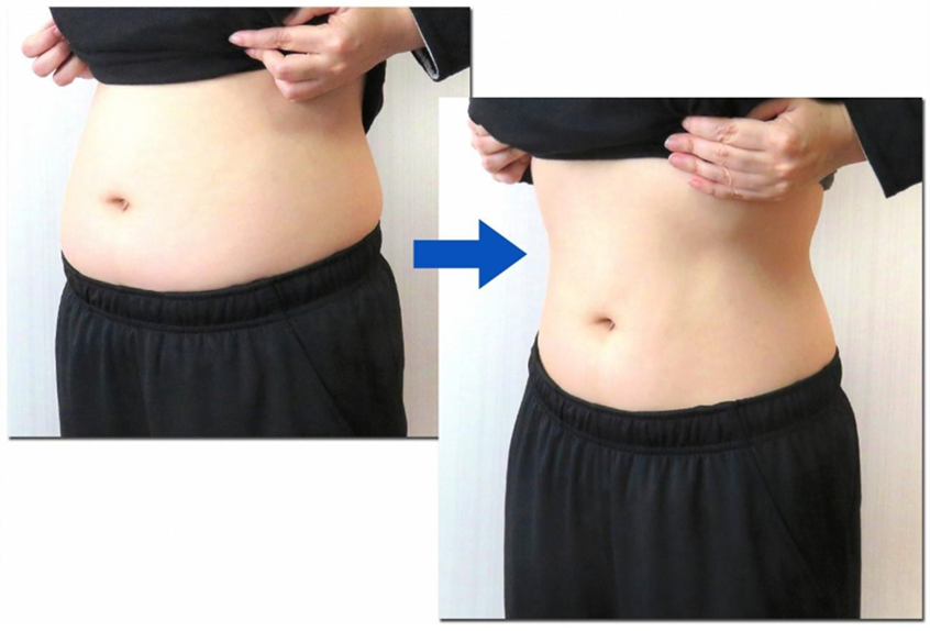 腸活の効果とメリット