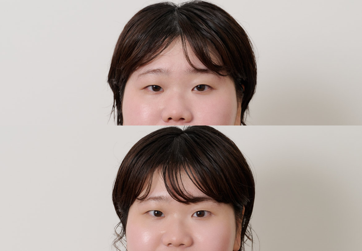 施術後は目元がすっきりし、肌のツヤ感もアップ