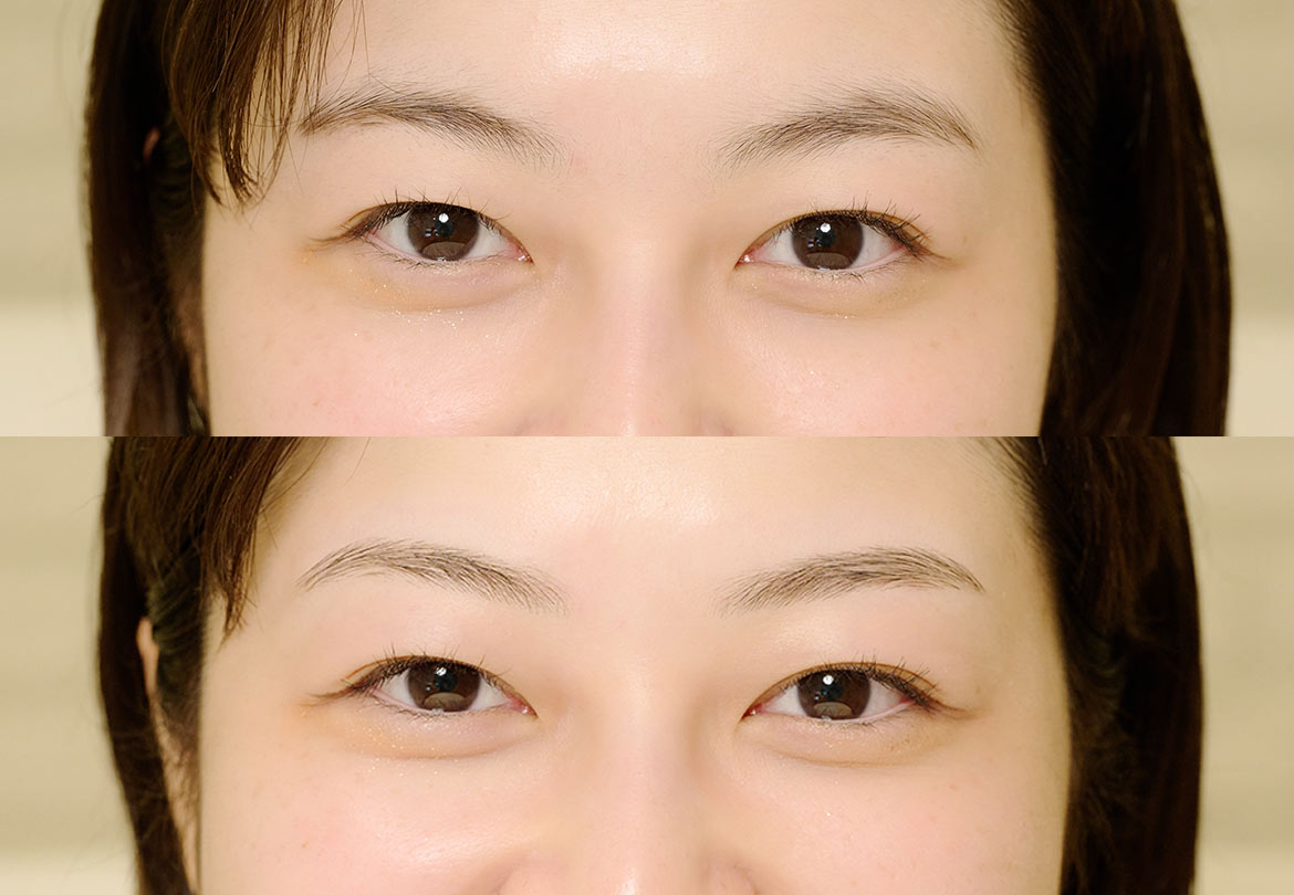 整った眉は、顔全体の美しさを引き出してくれる「アイブロウスタイリング（WAX）」6,600円