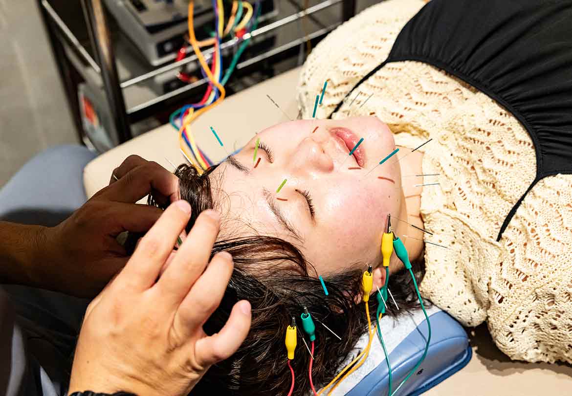 「美容鍼灸」は男女問わず施術可能